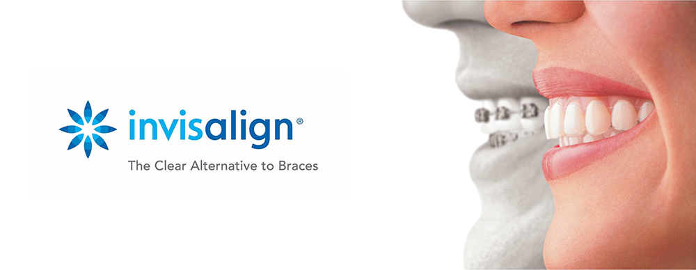 Invisalign | Austin Dentist